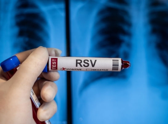 Can Urgent Care Test for RSV? - Lifeline Urgent Care